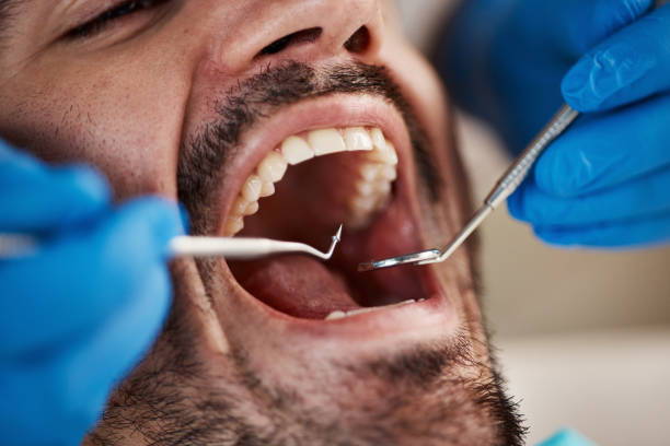 Best Emergency Broken Tooth Repair in River Park, FL